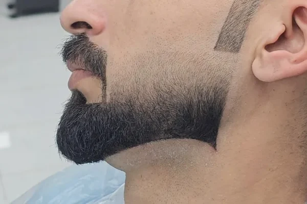 Dadhi Style